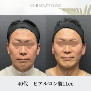 TFT 11cc 40代/Dr松元