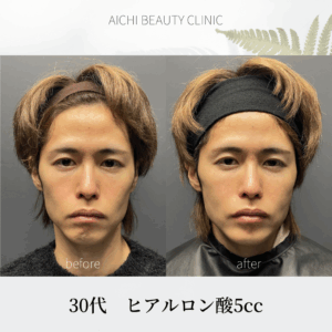 TFT 30代5cc/Dr松元