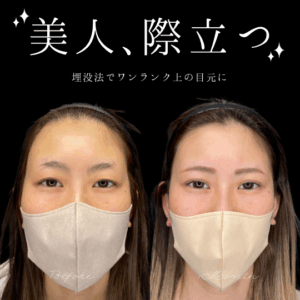 自然癒着法　20代　女性　/ 吉田Dr.