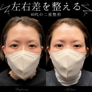 自然癒着法　40代　女性　/ 吉田Dr.