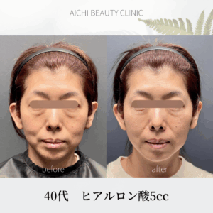 TFT 5cc 40代/Dr松元