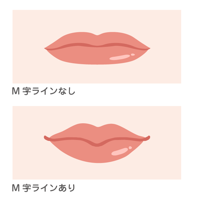 唇の形の違いを示すイラスト。上がM字ラインのない唇、下がM字ラインのある唇で、薄い口唇を厚く、ぽってりとした可愛らしい印象に。