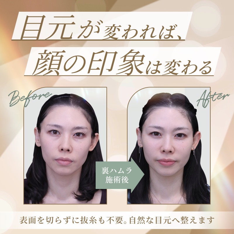 目元が変われば、顔の印象は変わる