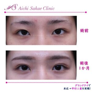 20代　グランドアイ（韓流特殊６点）