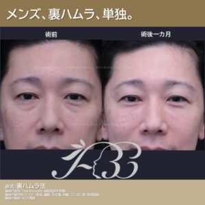 40代男性　裏ハムラ