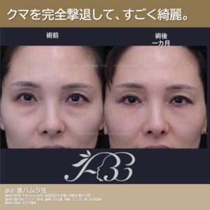 40代　表ハムラ