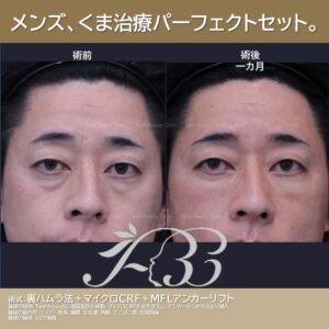 40代男性　クマパーフェクトセット