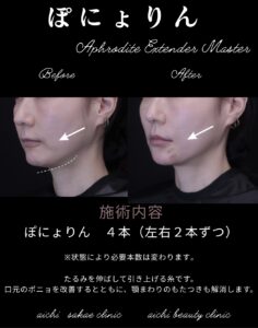 宮川先生執刀ぽにょりん