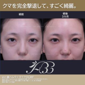 どんな表情でも魅せる裏ハムラ